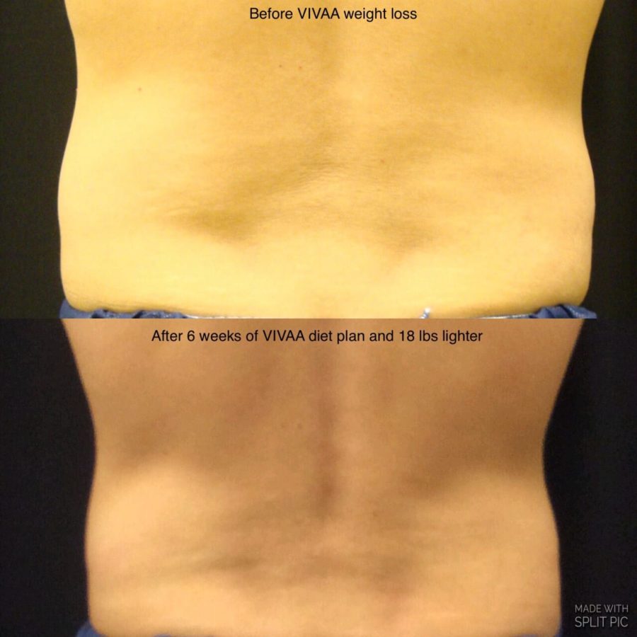 Before and after progress from a supervised medical weight loss program